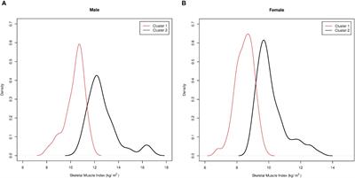 New specific skeletal muscle mass index cut-offs for the assessment of sarcopenia in patients with severe obesity